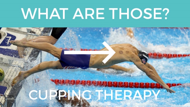 cuppingtherapy
